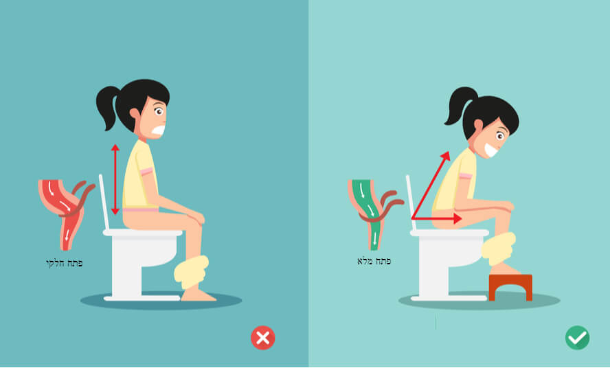 איך לשבת נכון בשירותים - תנוחה כריעה לעשיית צרכים מסייע לעצירות