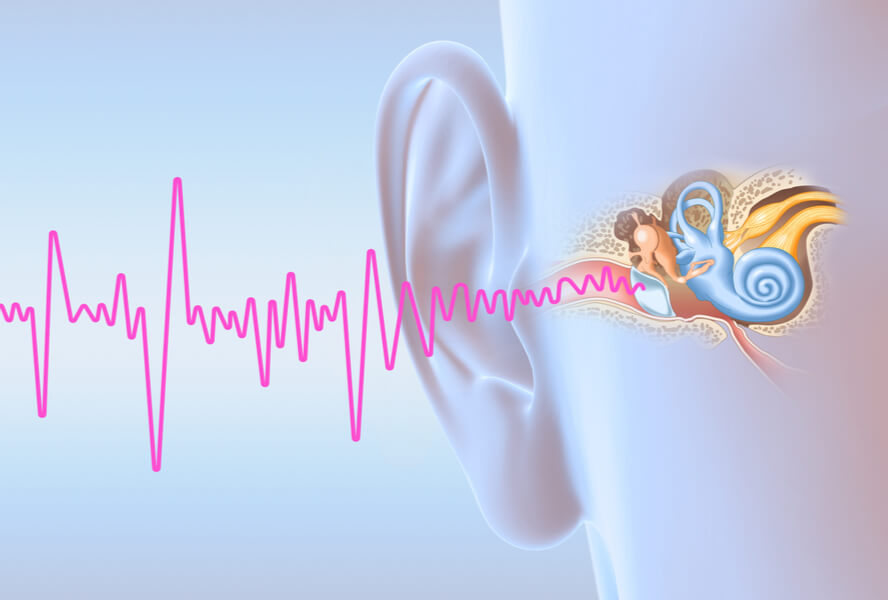 טיפול בטינטון באוזן באמצעות צלילים