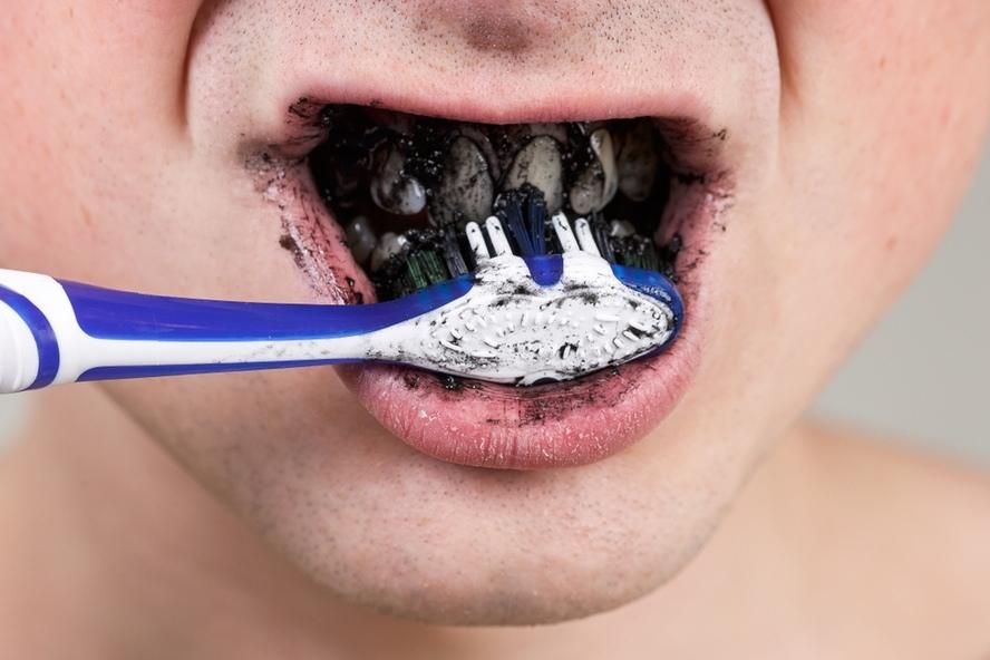 צחצוח שיניים עם פחם - הלבנת שיניים ביתית עם פחם