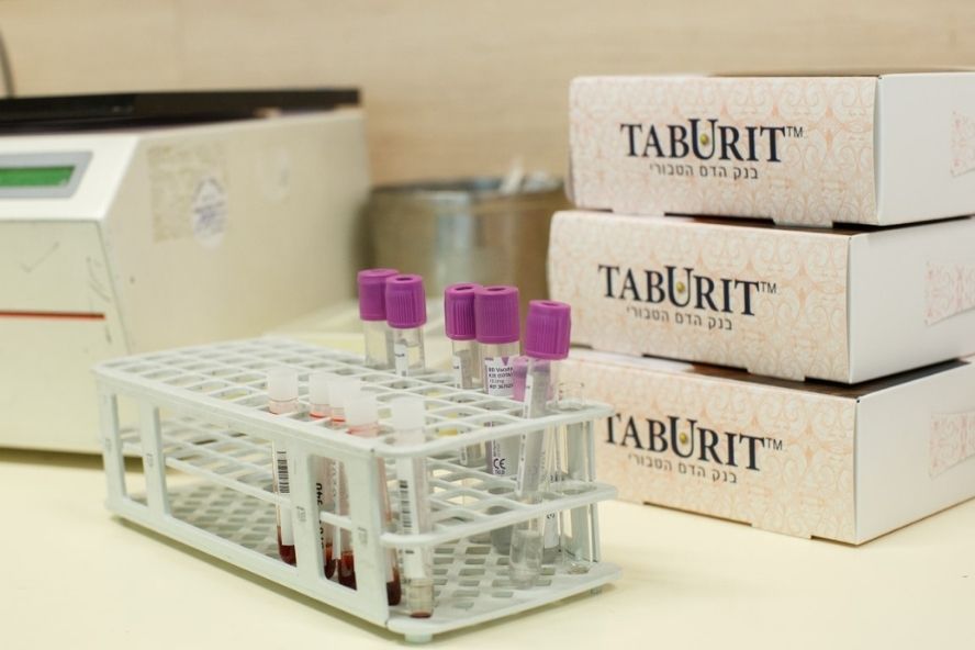 בנק דם טבורי: בדיקות מעבדה - שימור דם טבורי