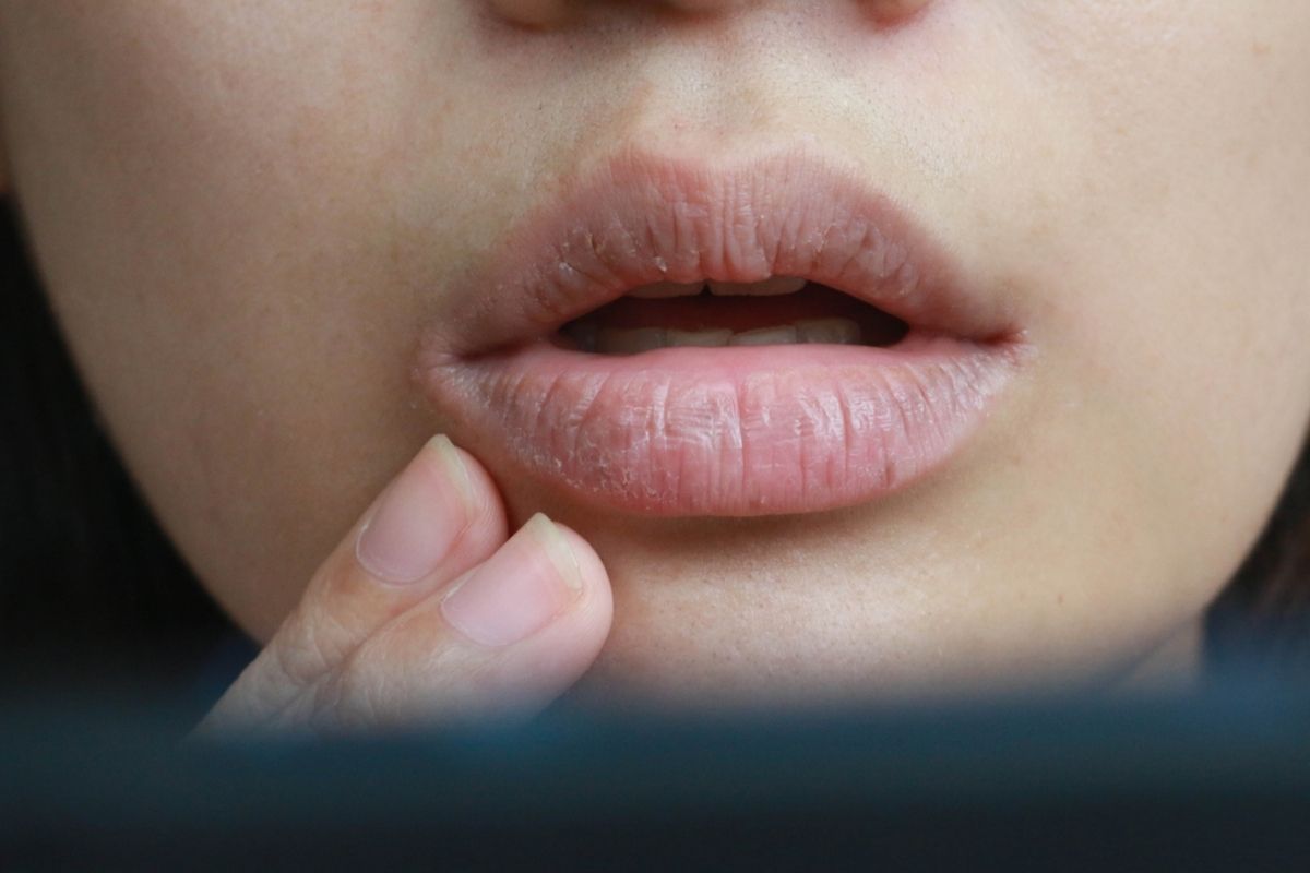 שוב יובש בשפתיים? | צילום: shutterstock