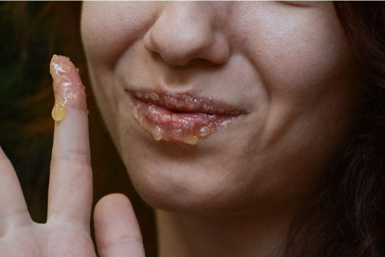 אישה מורחת דבש על השפתיים - יובש בשפתיים