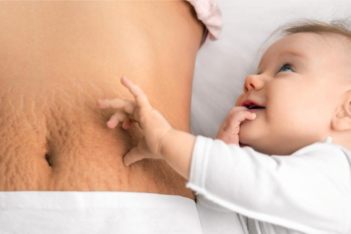 למעלה מ-50% מהנשים לאחר לידה יכירו אותם מקרוב | צילום: shutterstock